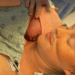 c-section delivery